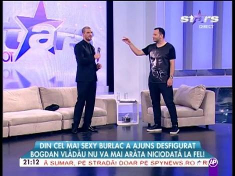 Aroganță supremă? Bogdan Vlădău a ajuns desfigurat, după ce și-a pus păr pe față: "E vorba de 5000 de fire pe barbă şi aproape 3000 pe scalp!"