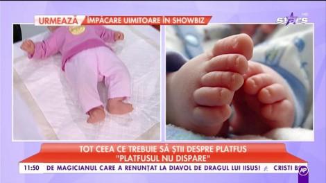 Tot ceea ce trebuie să știi despre platfus: ”Există platfus mobil și rigid”