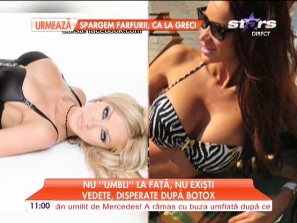 Nu "umbli" la fizic, nu prea ai succes! Vedetele din Rom&acirc;nia sunt disperate după botox