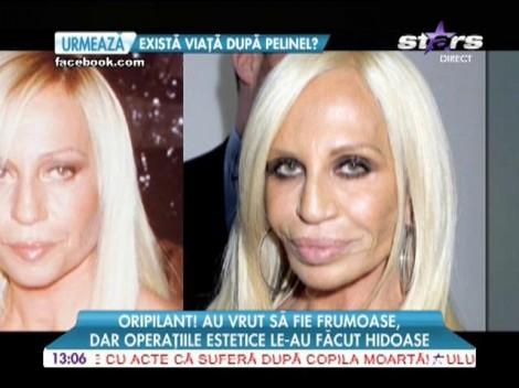 ORIPILANT! Au vrut să fie mai frumoase, dar operaţiile estetice le-au transformat în MONȘTRI