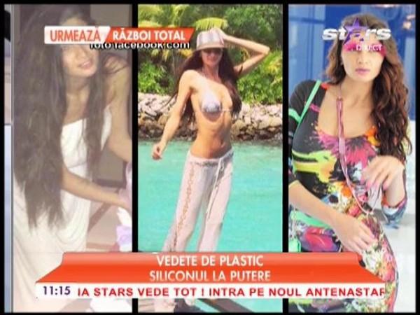 Vedetele "de plastic" sunt la mare căutare: Iată cui aparţin cele mai ciudate implanturi