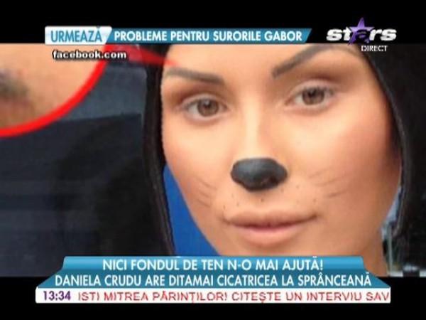 Daniela Crudu a rămas cu cicatrici VIZIBILE, după ce și-a spart capul la "Splash! Vedete la apă"