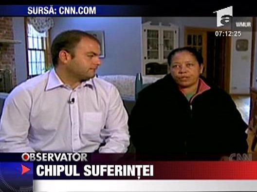 Chipul suferintei