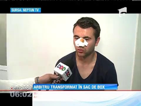 Arbitru din Liga a 4-a, desfigurat de suporteri &icirc;n timpul unui meci