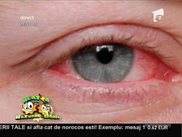 Bună dimineaţă, sănătate! Ochelarii de soare, utili și iarna