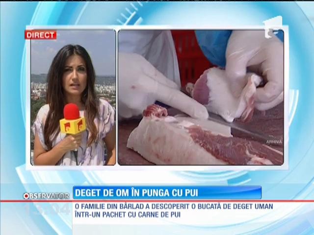 Bucată de deget uman &icirc;ntr-un pachet cu carne de pui