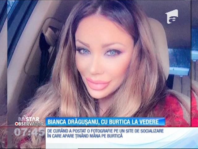 Bianca DrÄƒgusanu Nu Isi Mai Ascunde Burtica De GravidÄƒ Observatornews Ro