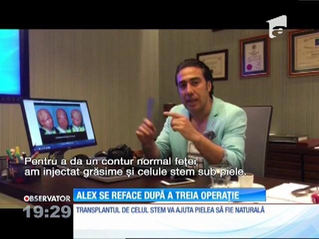 Alex, băiatul mutilat &icirc;ntr-o explozie, se reface după a treia operaţie de reconstrucţie