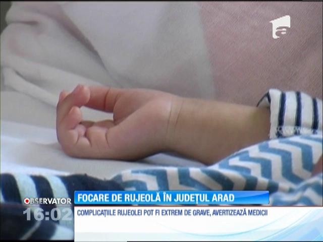 Două focare de rujeolă &icirc;n județul Arad