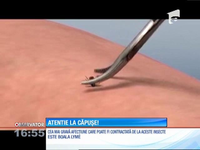 Aproape 100 de persoane din Buzău au ajuns de urgență la spital după ce au fost mușcate de căpușe