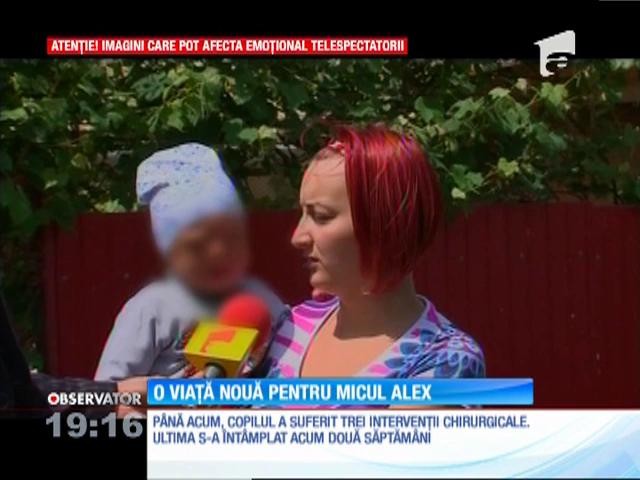 O nouă viaţă pentru micul Alex, băieţelul rănit grav &icirc;n explozia unei maşini