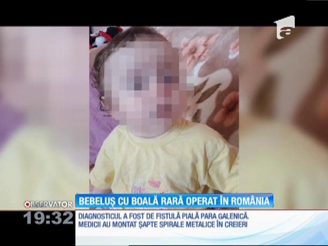 Bebeluș cu o boală foarte rară, operat cu succes &icirc;n Rom&acirc;nia