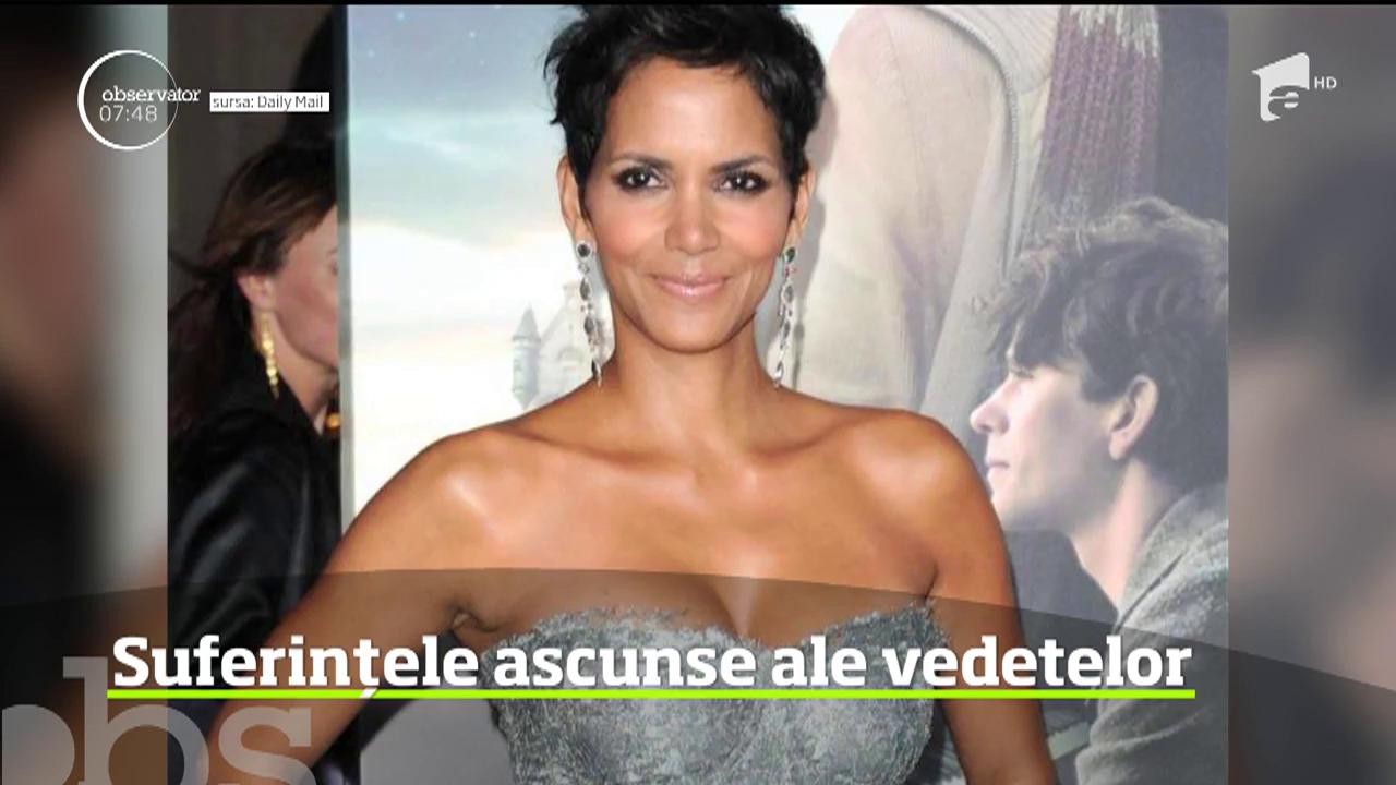 Suferințele ascunse ale vedetelor