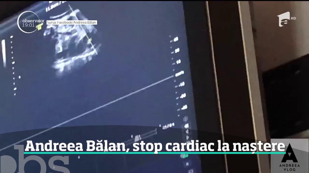C&acirc;ntăreaţa Andreea Bălan a fost resuscitată &icirc;n sala de naşteri. Vedeta a suferit un stop cardio-respirator