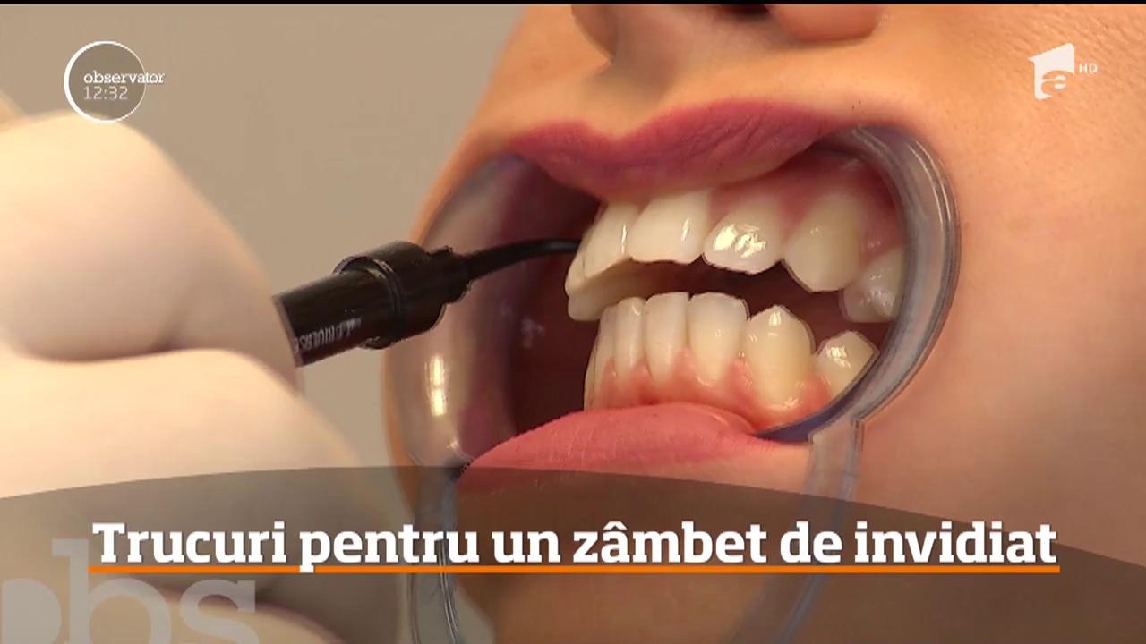 Trucuri pentru un z&acirc;mbet de invidiat. Dinți mai albi cu șase nuanțe &icirc;n 20 minute