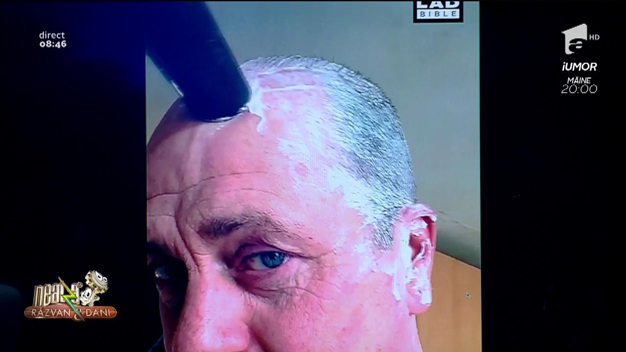 Smiley News. Aspiratorul, cea mai bună metodă de a răm&acirc;ne fără păr pe cap