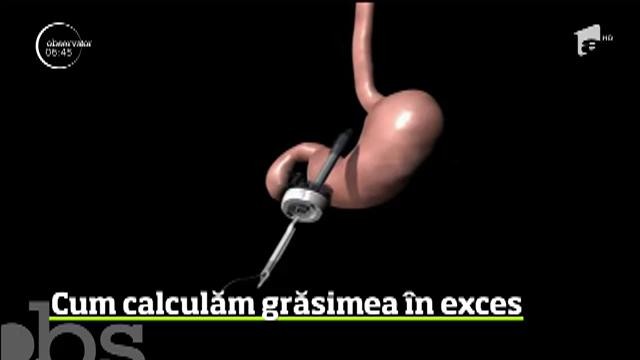 Kilogramele &icirc;n plus sunt tot mai mult o problemă &icirc;n r&acirc;ndul rom&acirc;nilor. Specialiştii ne &icirc;nvață cum să ne calculăm grăsimea &icirc;n exces
