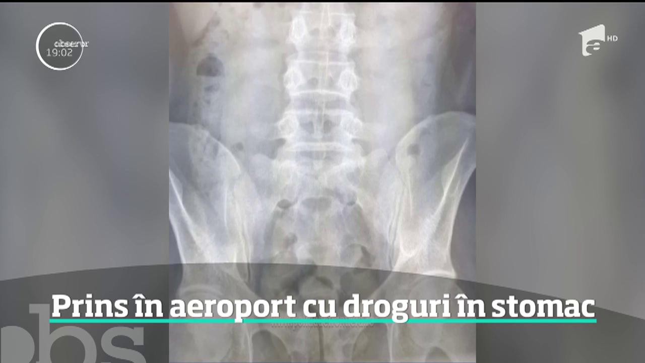 Un t&acirc;năr care a &icirc;nghiţit aproape 150 de grame de cocaină a fost prins pe aeroportul Otopeni