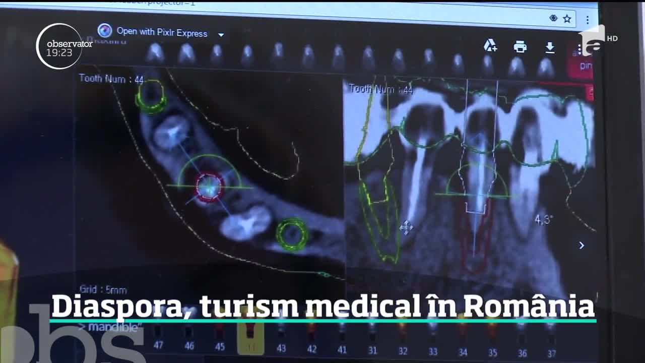 Rom&acirc;nii din străinătate fac turism medcal &icirc;n ţară