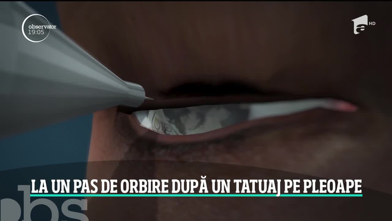 O t&acirc;nără a fost la un pas să-şi piardă vederea după ce şi-a făcut un tatuaj pe pleoapă &icirc;n casa unei cosmeticiene din Iaşi