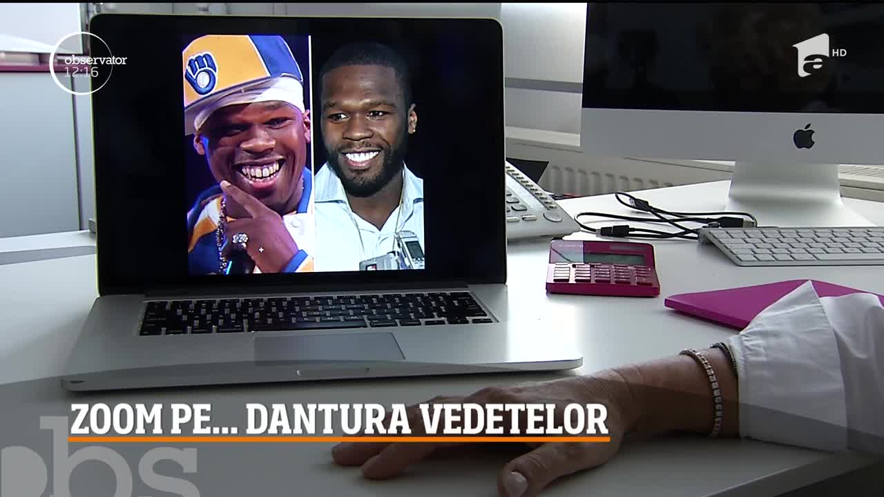 Totul despre fațetele dentare ale vedetelor. Ce ne recomandă specialistul!
