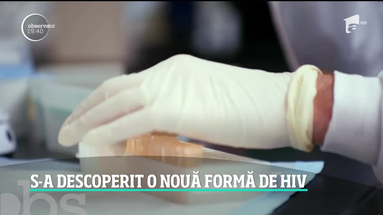 Anunţ &icirc;ngrijorător al oamenilor de ştiinţă: a fost descoperită o nouă formă de HIV