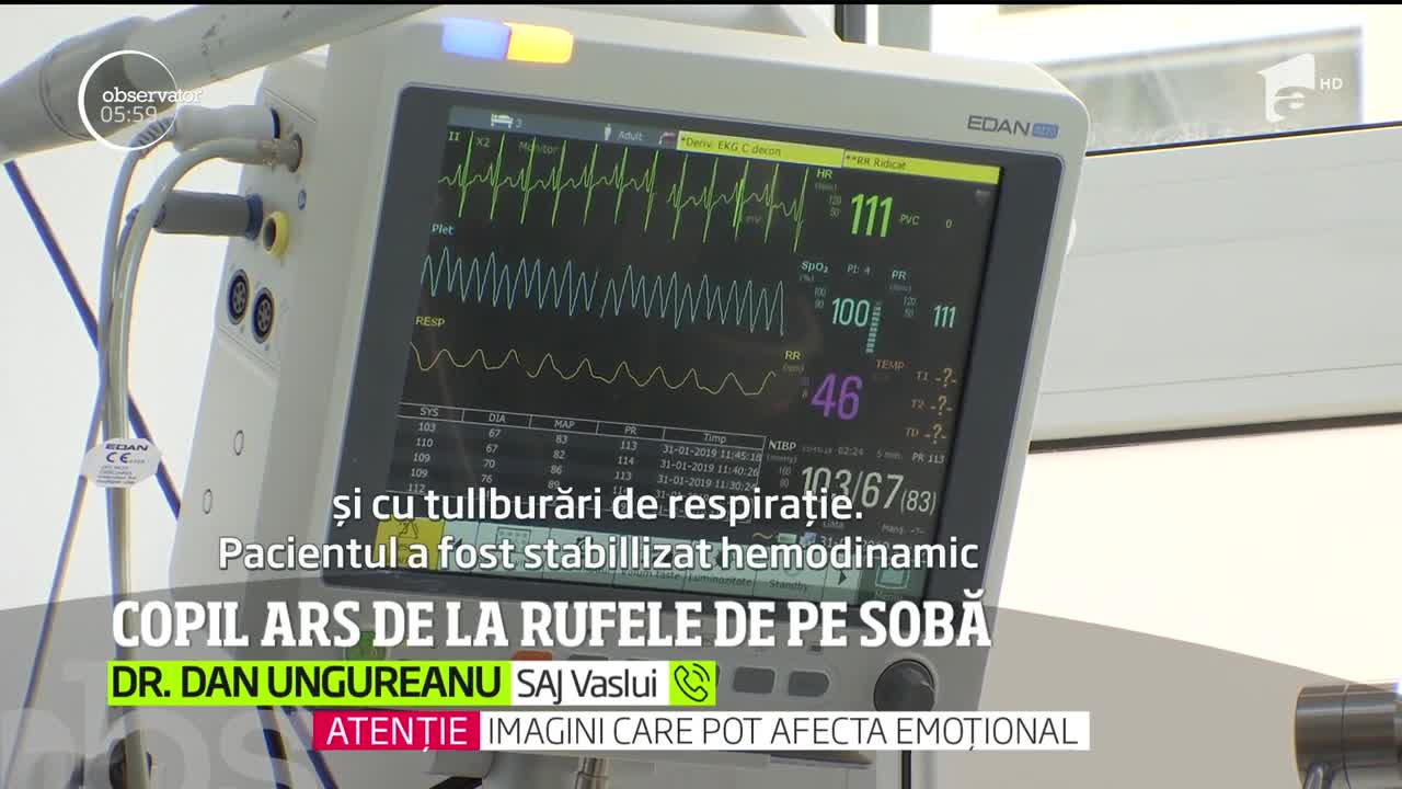 Un copil de trei ani din Vaslui se zbate &icirc;ntre viaţă şi moarte, cu arsuri pe aproape toată suprafaţa corpului