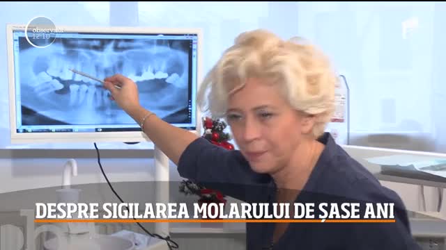 Soluții la problemele dentare! Totul despre sigilarea molarului de șase ani