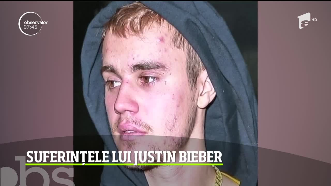 Mărturisire dramatică a lui Justin Bieber. El a dezvăluit că suferă de maladia Lyme