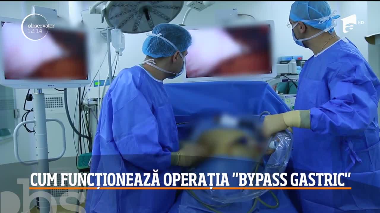 Chirurgia bariatrică, pe înțelesul tuturor. Ce presupune intervenția „Gastric Sleeve”, prin care a slăbit Ozana Barabancea! Video