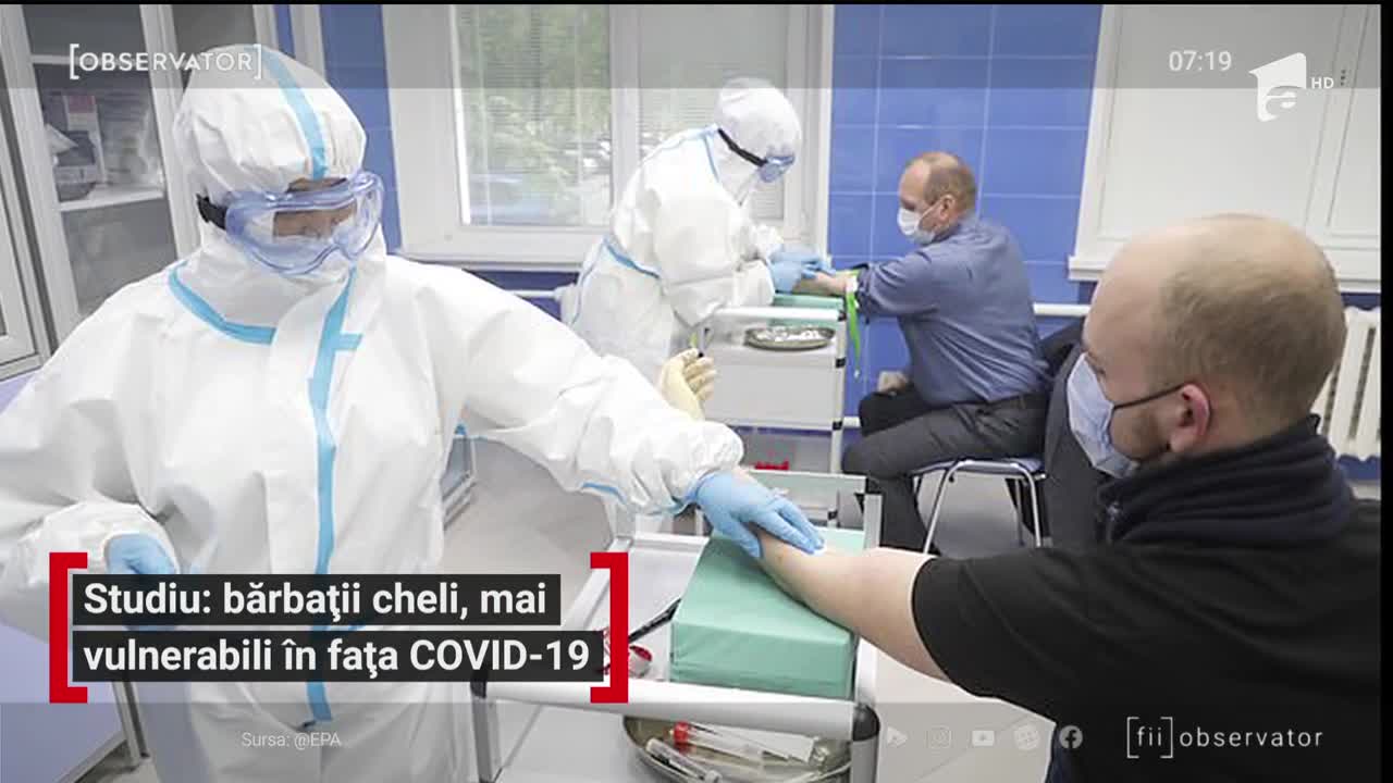 Studiu: bărbații cu chelie, mai vulnerabili &icirc;n fața Covid-19