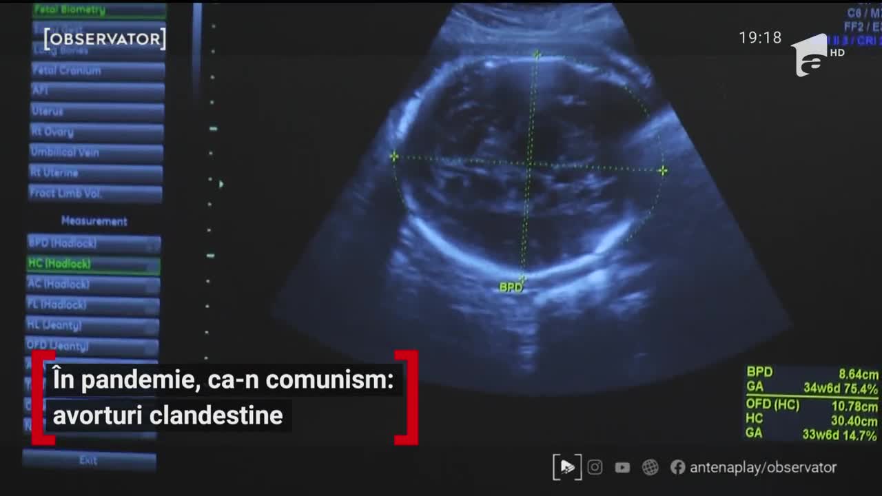 &Icirc;n pandemie, ca-n comunism: avorturi clandestine