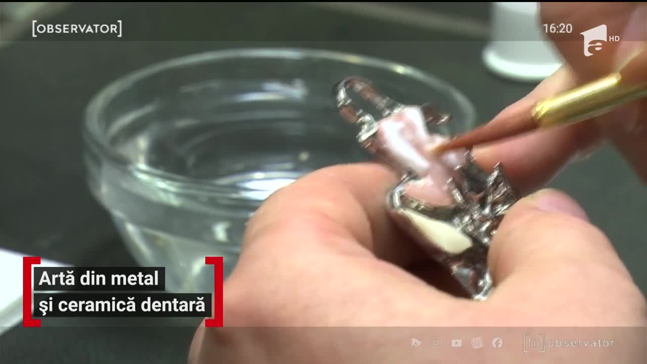 Artă din metal și ceramică dentară