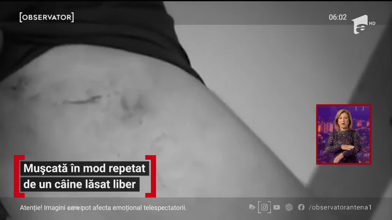 O t&acirc;nără de 15 ani din Constanţa, mușcată &icirc;n mod repetat de un c&acirc;ine lăsat liber