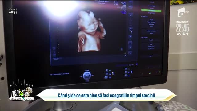 C&acirc;nd și de ce este bine să faci ecografii &icirc;n timpul sarcinii