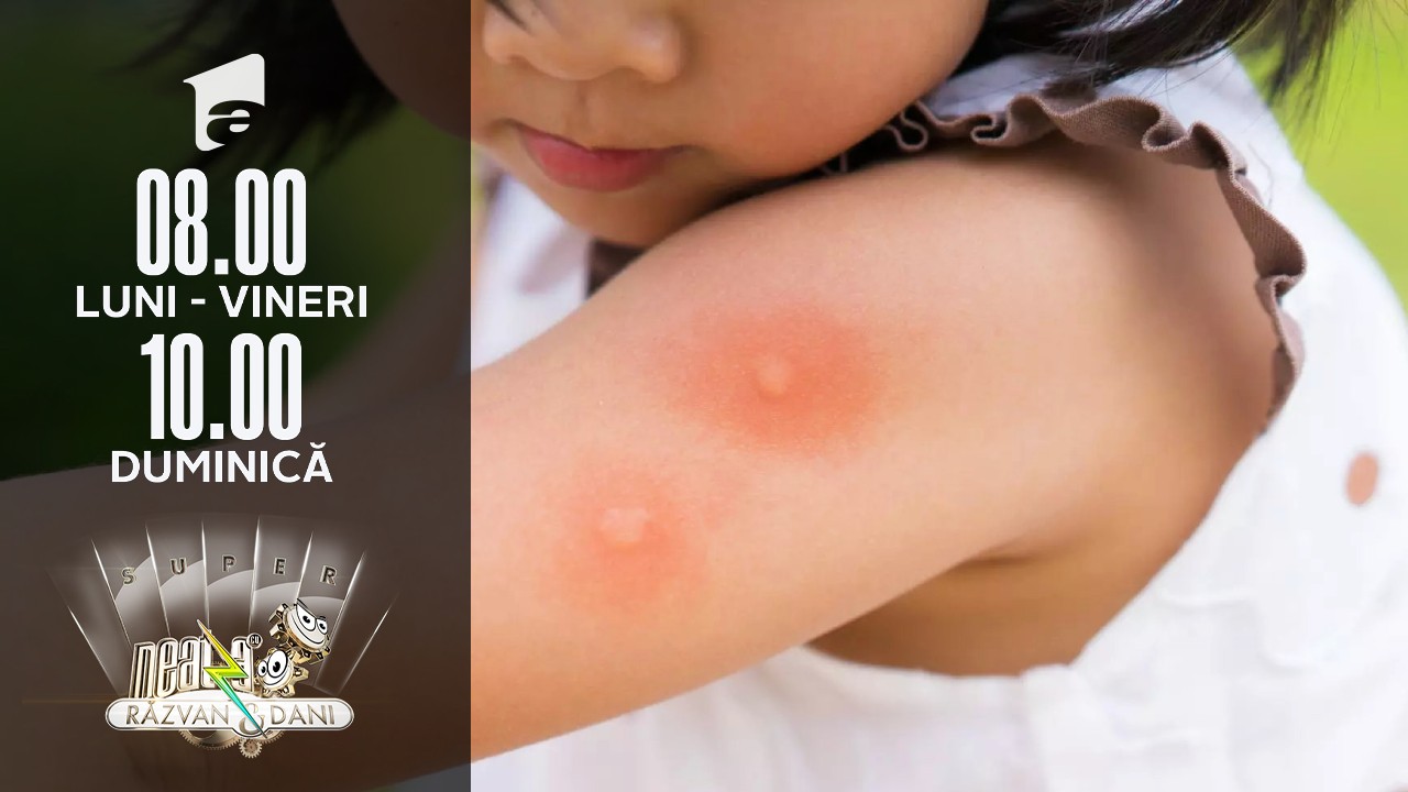 Ce facem dacă cel mic a fost mușcat de o căpușă