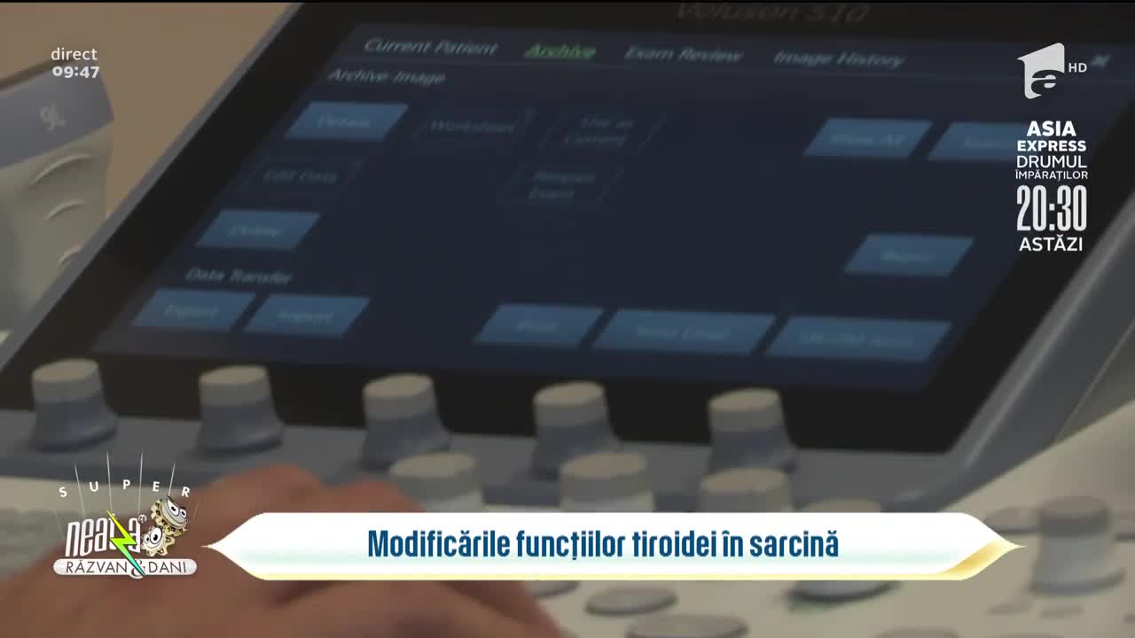 Super Neatza, 18 octombrie 2021. Modificările funcțiilor tiroidei în sarcină