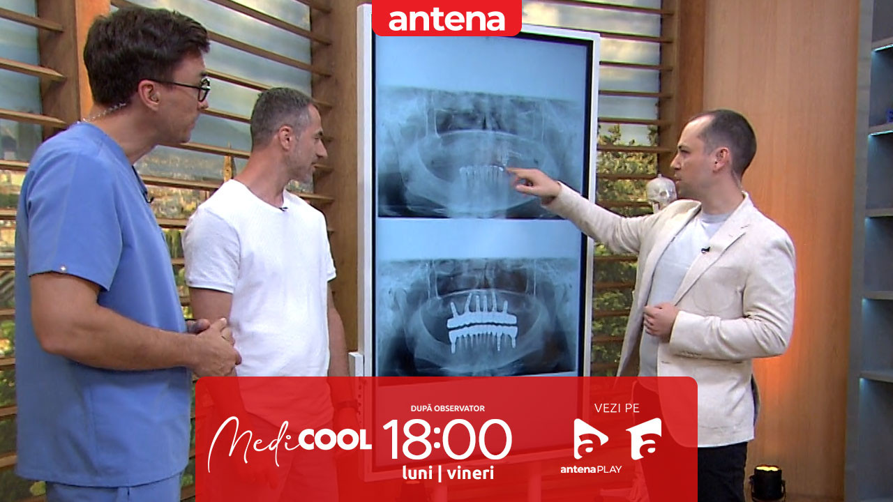 Medicool sezonul 9, 10 octombrie 2025. Problemele dentare care pot afecta gustul! Cum se poate trata această afecțiune