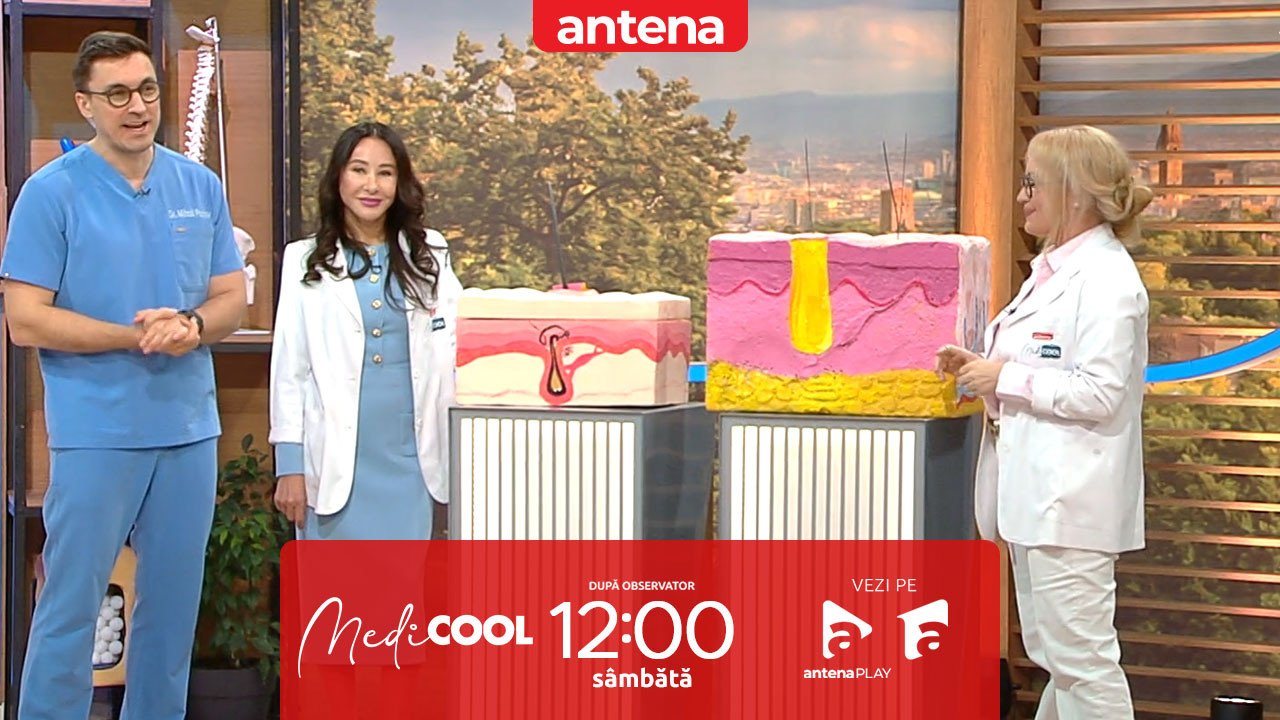 Medicool | Sezonul 10. Cum decurge un transplant de păr? Medicii explică procedura pas cu pas