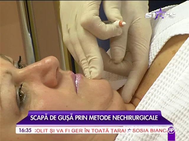 Scapa de gusa prin metode nechirurgicale