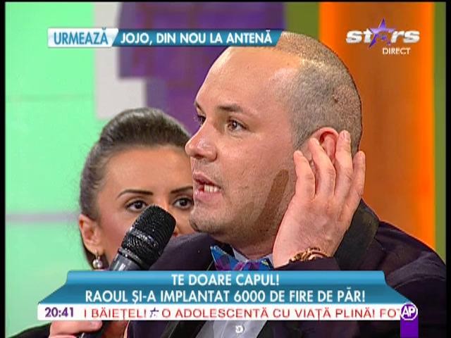 Raoul si-a implantat 6.000 de fire de par