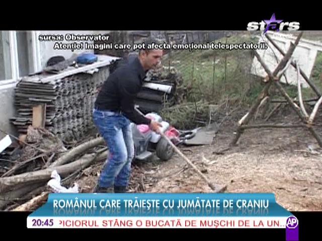 Romanul care traieste cu jumatate de craniu