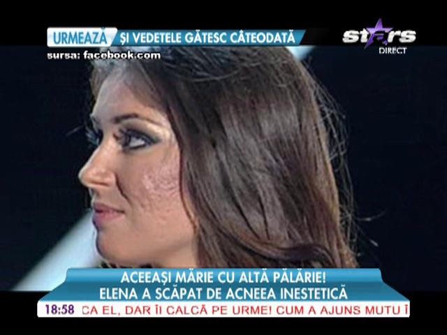 Elena a scapat de acnee