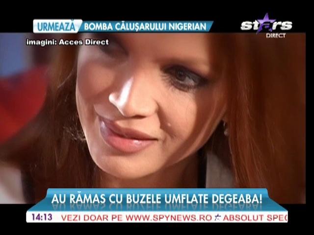 Vedete cu buzele umflate