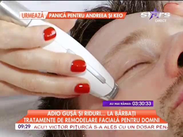 Tratament de remodelare faciala pentru barbati