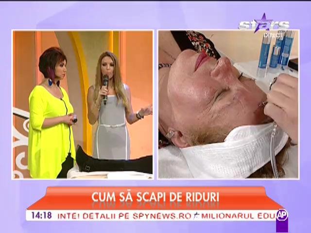 Cum sa scapi de riduri