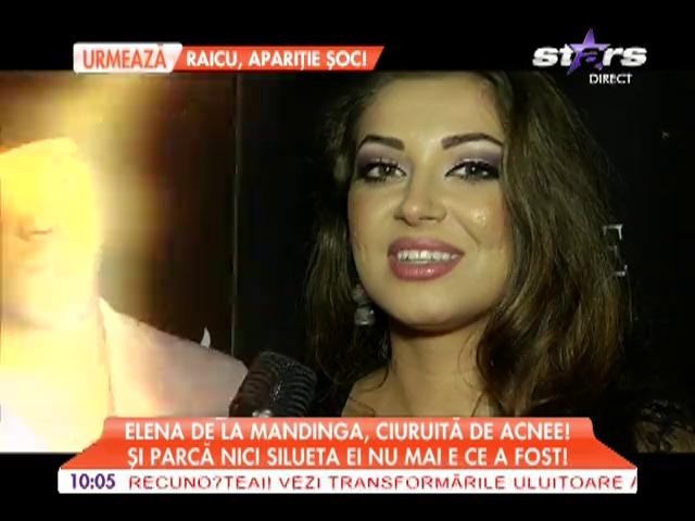 Elena de la Mandinga, ciuruită de acnee! Nici silueta nu mai e ce a fost!