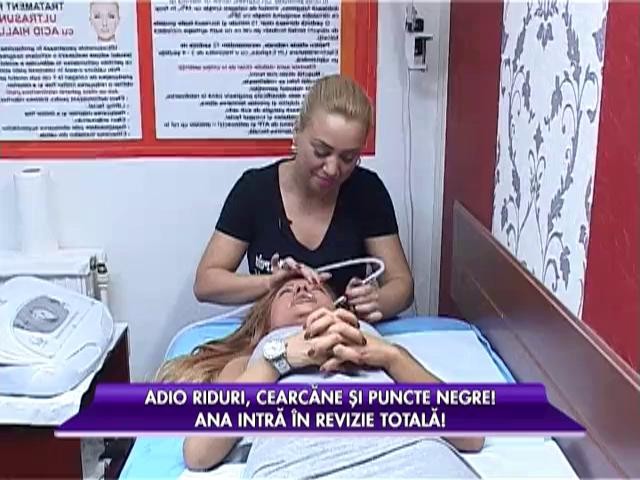 Ana Mocanu, tratament împotriva cearcănelor, punctelor negre și ridurilor