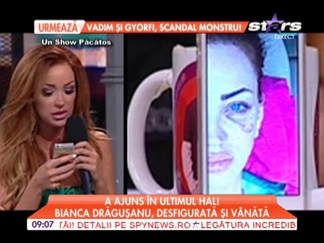 Bianca Drăguşanu, desfigurată şi v&acirc;nătă