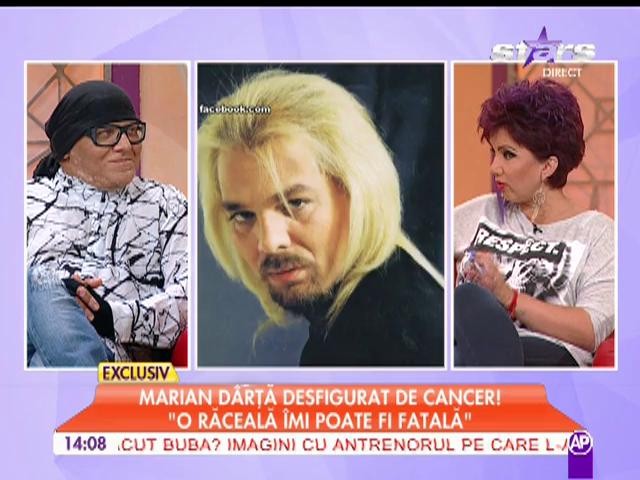Marian D&acirc;rţă, desfigurat de cancer!
